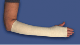Tubular Support-Compression Bandage (SpandaGrip™)